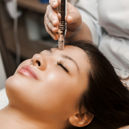 microneedling behandlung